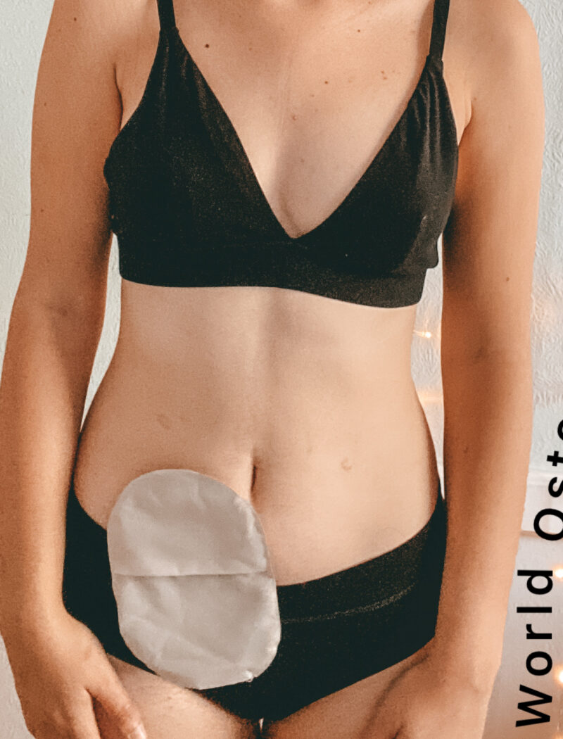 Stomas : Close up of coloplast stoma with world ostomy day text wrapped around