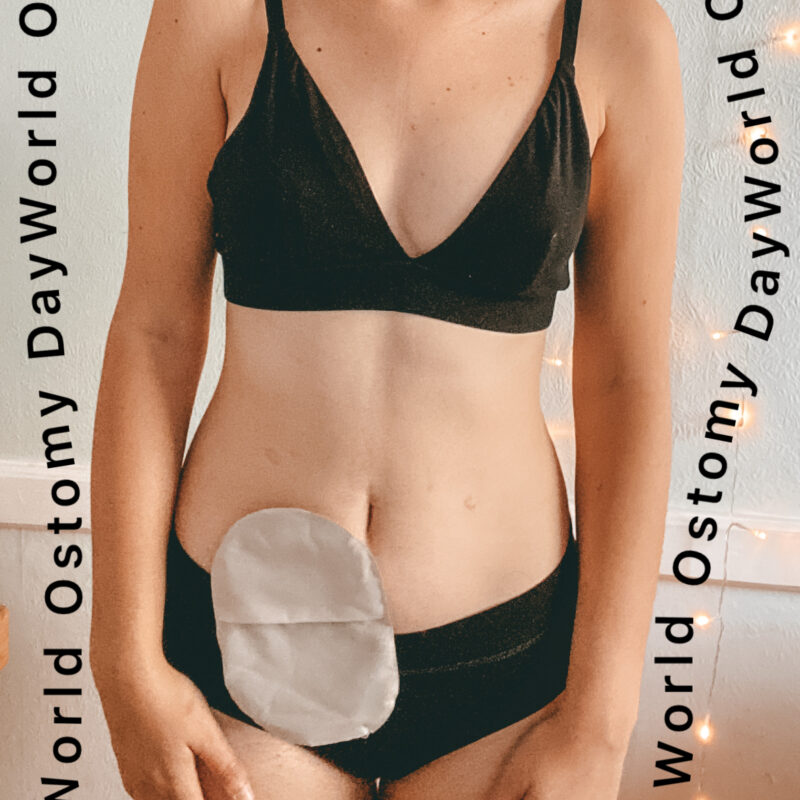 Stomas : Close up of coloplast stoma with world ostomy day text wrapped around